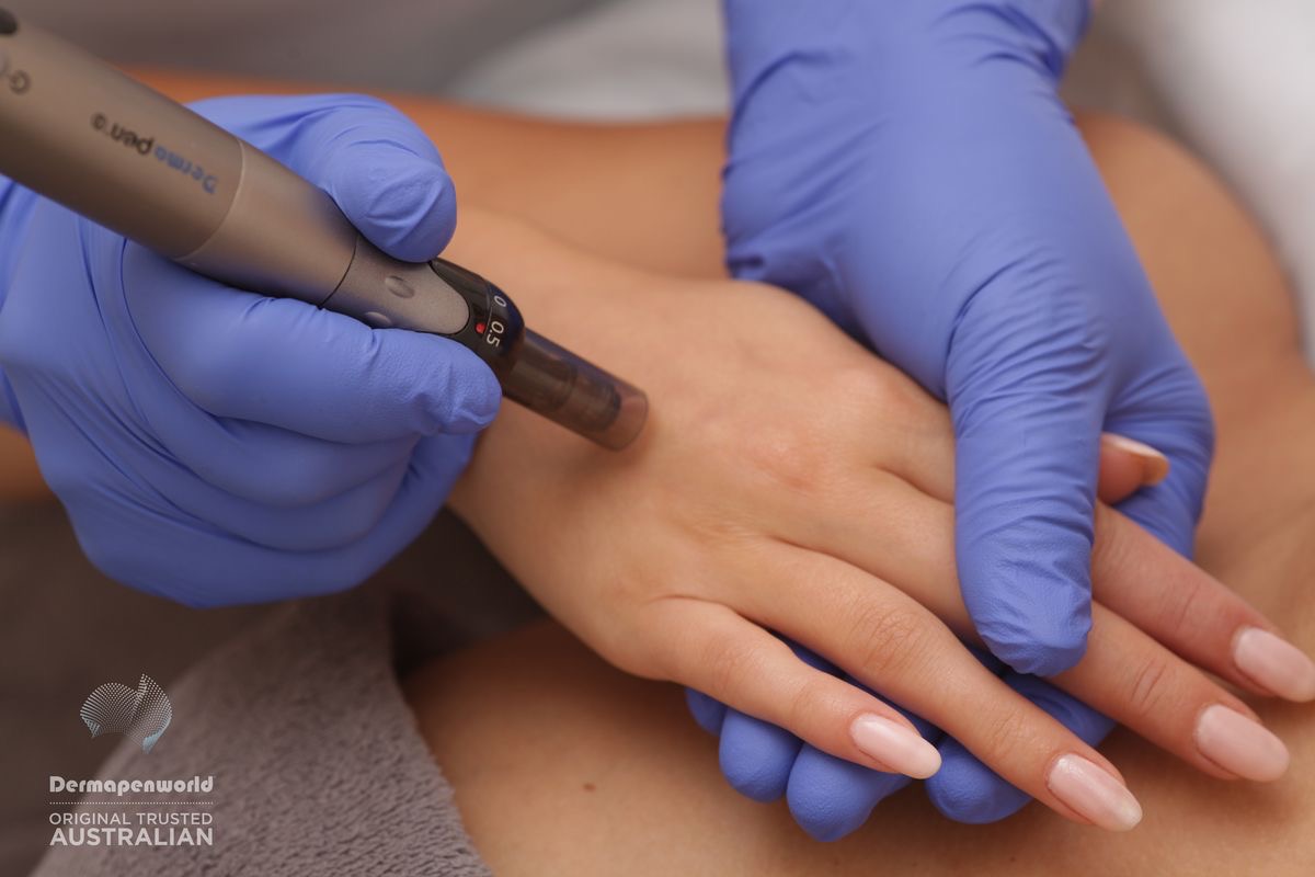 DermaPen mâini