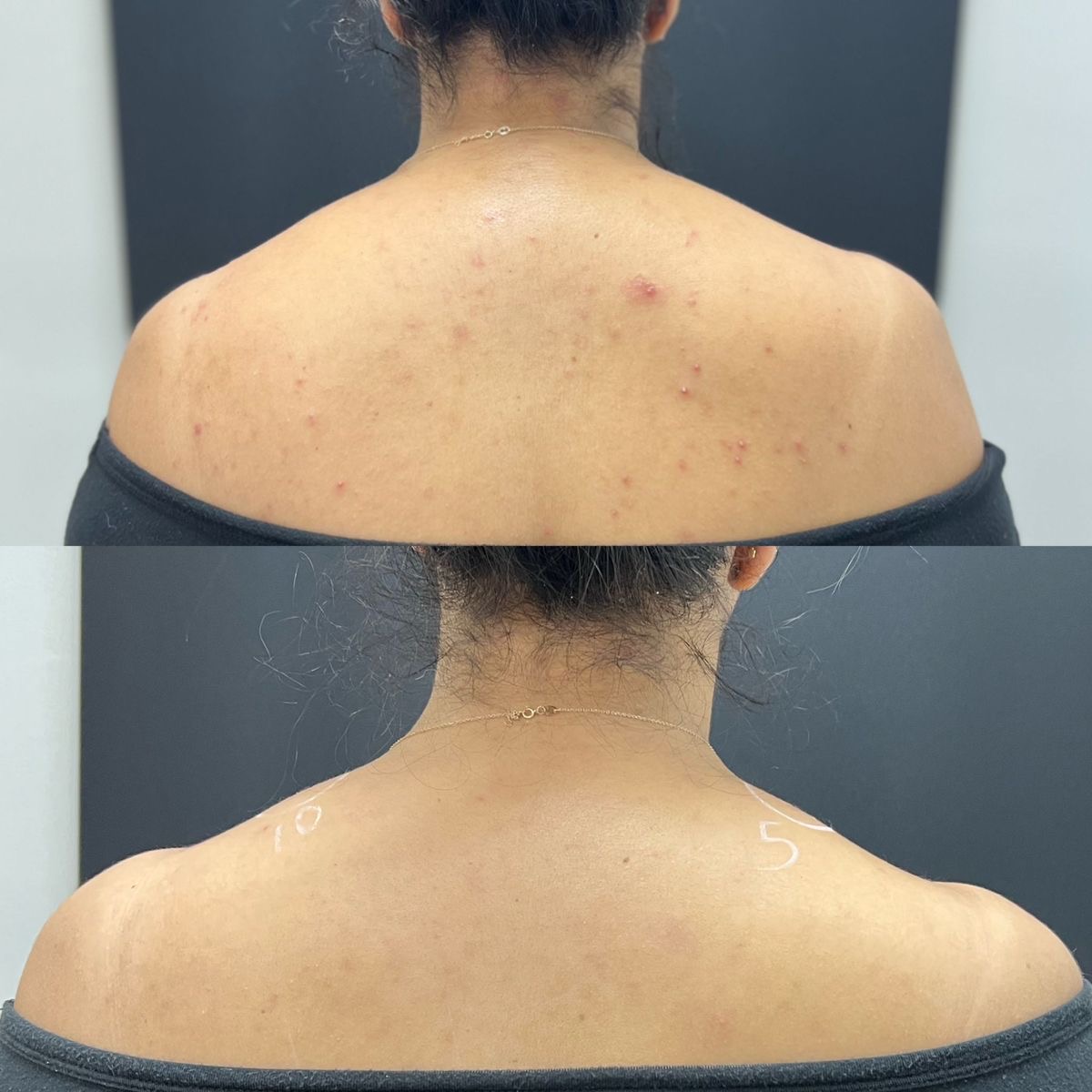 After Body Care
