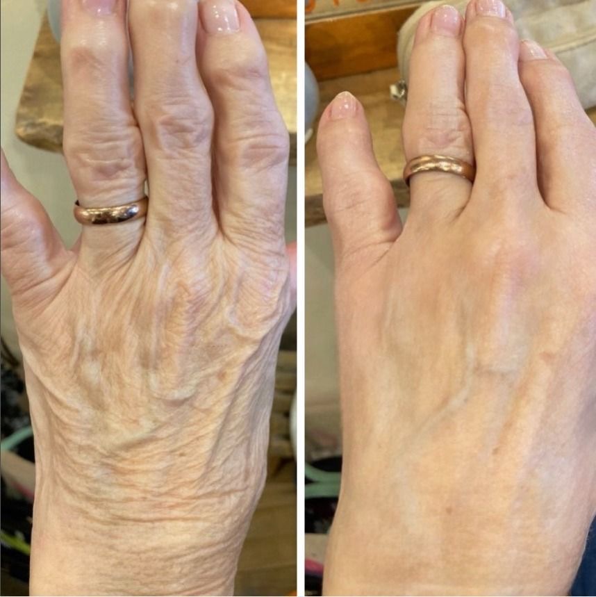 After Body Care