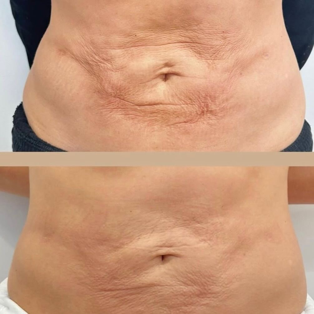 After Body Care