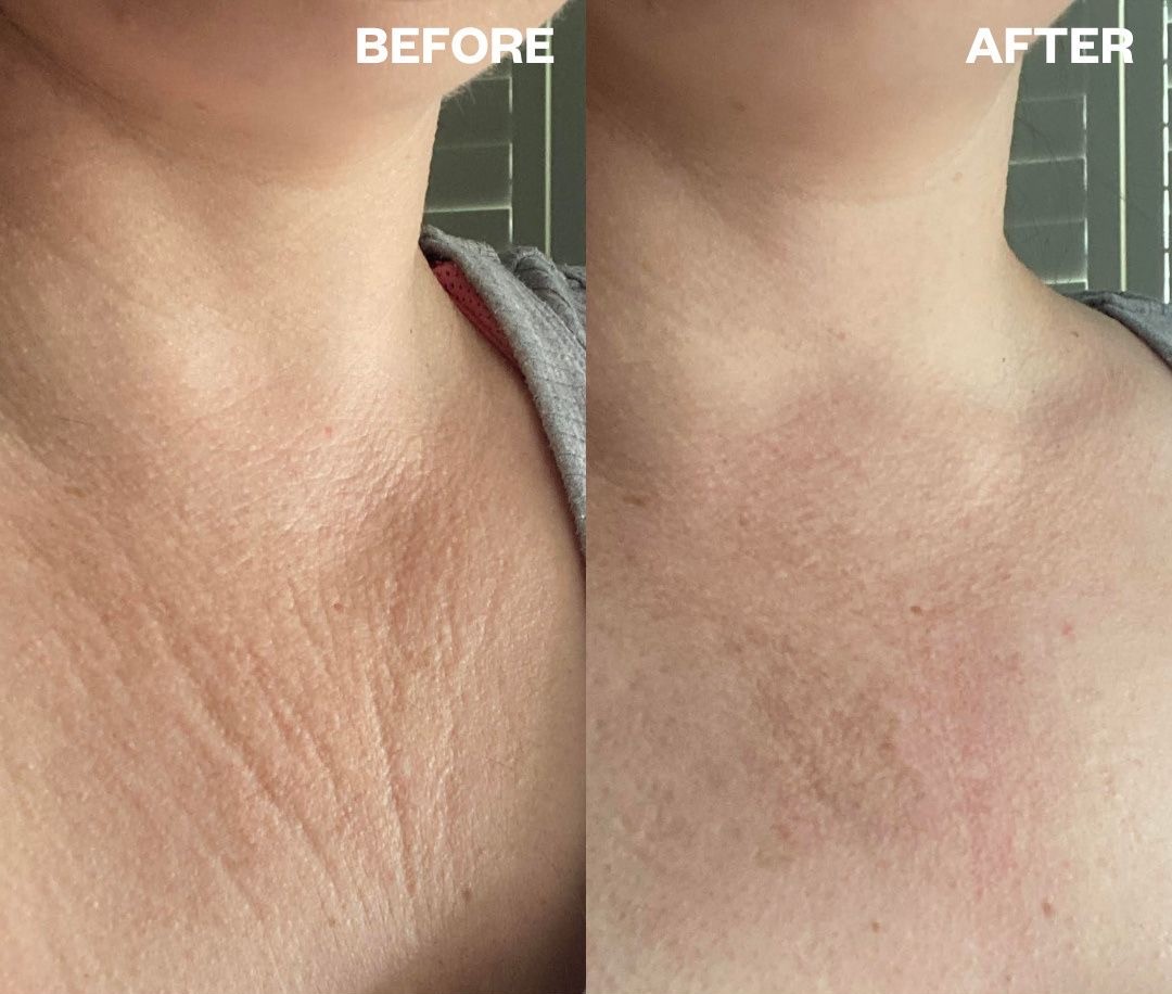 Before Body Care